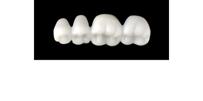 Cod.EXLOWER RIGHT: 15x  posterior hollow wax veneers-bridges, X-LARGE, (44-47), with precarved occlusion to Cod.EXUPPER RIGHT, and compatible to Cod.SXLOWER RIGHT (solid), (44-47)